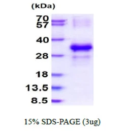 Human C7orf36 protein, His tag. GTX68646-pro