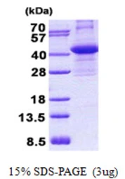 Human CIAPIN1 protein, His tag. GTX68647-pro