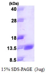 Human S100A14 protein, His tag. GTX68656-pro