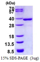 Human NMRAL1 protein, His tag. GTX68658-pro