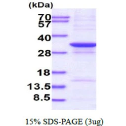 Human AADACL1 protein, His tag. GTX68662-pro