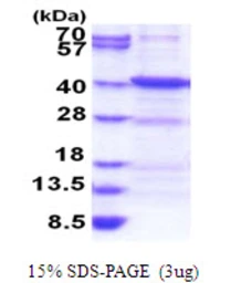 Human ANKRA2 protein, His tag. GTX68666-pro