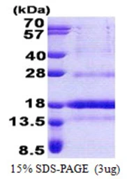 Human POLD4 protein, His tag. GTX68667-pro