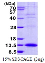 Human LSM2 protein, His tag. GTX68668-pro