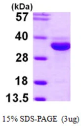 Human ENOPH1 protein, His tag. GTX68670-pro