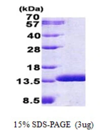Human ABRACL protein, His tag. GTX68674-pro