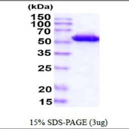 Mouse Visfatin protein, His tag. GTX68676-pro