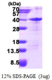 Human ZFAND3 protein, His tag. GTX68681-pro