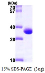Human PBLD protein, His tag. GTX68688-pro