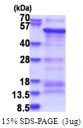 Human SAMSN1 protein, His tag. GTX68689-pro