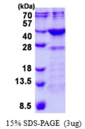 Human FN3K protein, His tag. GTX68692-pro