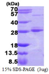 Human RAB17 protein, His tag. GTX68694-pro