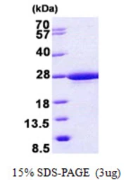Human RABL5 protein, His tag. GTX68701-pro