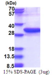 Human UBE2Z protein, His tag. GTX68709-pro