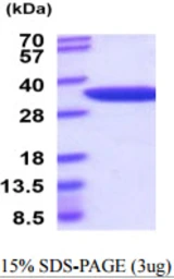Mouse NMNAT1 protein, His tag. GTX68711-pro