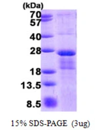 Human MRI protein, His tag. GTX68716-pro