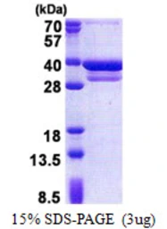 Human CUEDC2 protein, His tag. GTX68718-pro