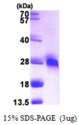 Human GGCT protein, His tag. GTX68720-pro