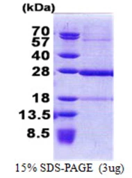 Human C19orf50 protein, His tag. GTX68723-pro