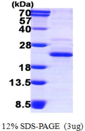 Human XTP3TPA protein, His tag. GTX68726-pro