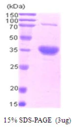 Human Livin protein, His tag. GTX68731-pro