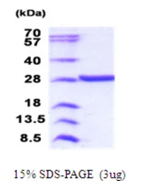 Human C14orf138 protein, His tag. GTX68733-pro
