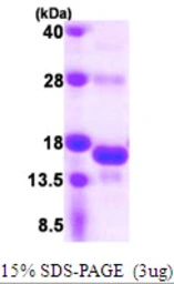 Human SNRNP25 protein, His tag. GTX68734-pro