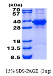 Human FN3KRP protein, His tag. GTX68740-pro