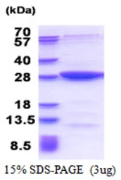 Human MOBKL2B protein, His tag. GTX68745-pro