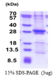 Human SIKE1 protein, His tag. GTX68753-pro