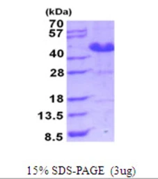 Human ASRGL1 protein, His tag. GTX68755-pro