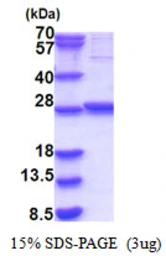 Human GLTPD1 protein, His tag. GTX68761-pro