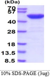 Human SETD7 protein. GTX68765-pro