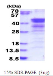 Human Nudel protein, His tag. GTX68768-pro