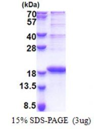 Human LBH protein, His tag. GTX68771-pro