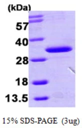 Human HDHD3 protein, His tag. GTX68777-pro