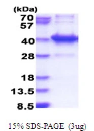Human AMMECR1L protein, His tag. GTX68782-pro