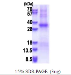 Human TSSK6 protein, His tag. GTX68793-pro