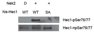 Anti-Hec1 (phospho Ser 76/77) antibody used in Western Blot (WB). GTX70015