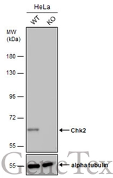 Anti-Chk2 antibody [4B8] used in Western Blot (WB). GTX70100