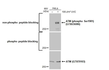 Anti-ATM antibody [2C1] used in Western Blot (WB). GTX70103