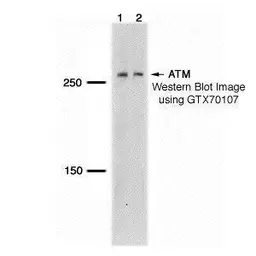 Anti-ATM antibody [5C2] used in Western Blot (WB). GTX70107