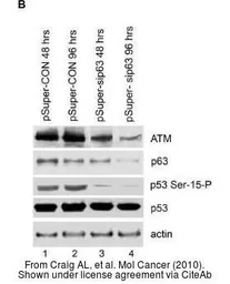 Anti-ATM antibody [5C2] used in Western Blot (WB). GTX70107