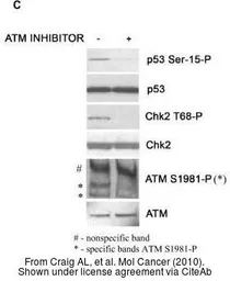 Anti-ATM antibody [5C2] used in Western Blot (WB). GTX70107