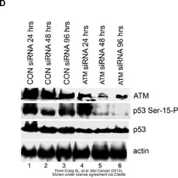 Anti-ATM antibody [5C2] used in Western Blot (WB). GTX70107