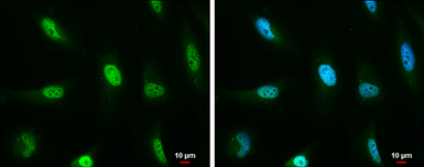 Anti-ATM antibody [5C2] used in Immunocytochemistry/ Immunofluorescence (ICC/IF). GTX70107