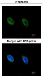 Anti-ATR antibody [2B5] used in Immunocytochemistry/ Immunofluorescence (ICC/IF). GTX70109