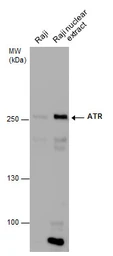 Anti-ATR antibody [2B5] used in Western Blot (WB). GTX70109