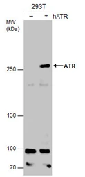 Anti-ATR antibody [2B5] used in Western Blot (WB). GTX70109