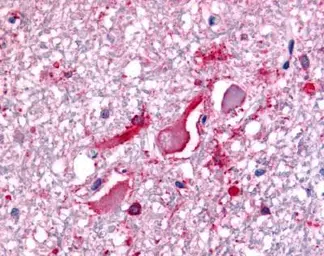 Anti-BRCA1 antibody used in Immunohistochemistry (IHC). GTX70134